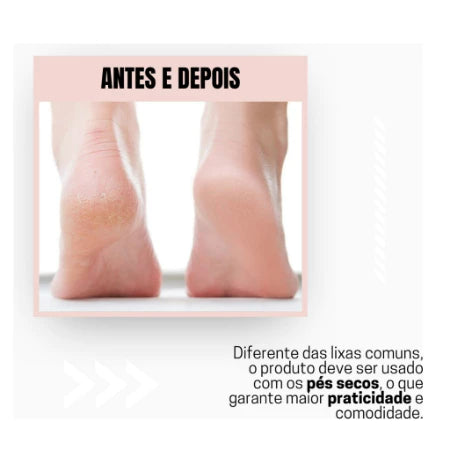 Esfoliador Elétrico para os Pés