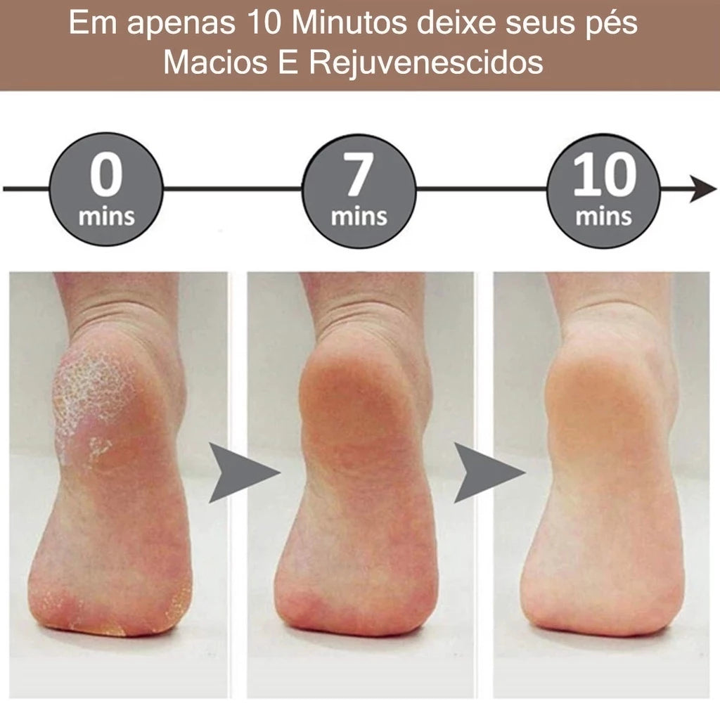 Esfoliador Elétrico para os Pés