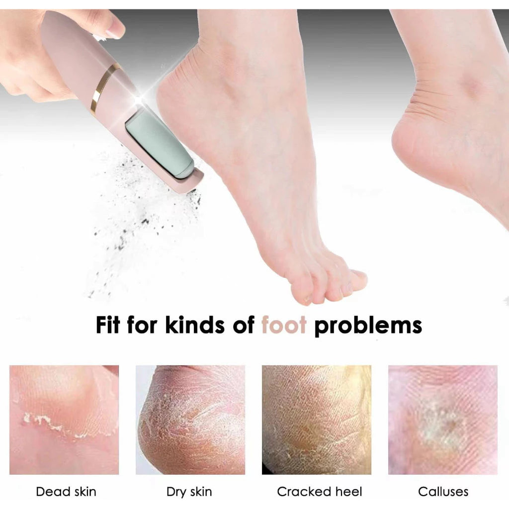 Esfoliador Elétrico para os Pés