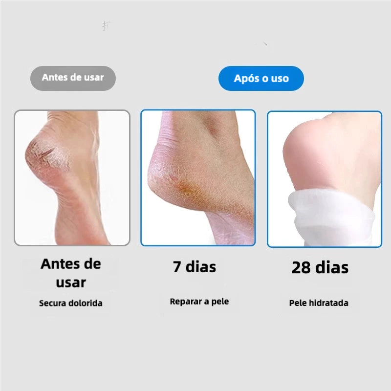HidraFeet Resultados