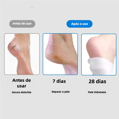 HidraFeet Resultados