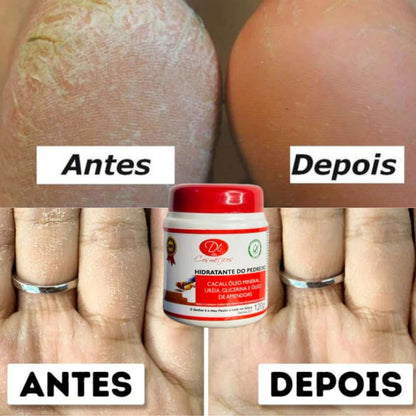 Kit Tratamento Pés de Sede (Lixa + Hidratante)