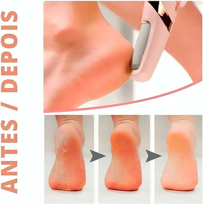 Kit Tratamento Pés de Sede (Lixa + Hidratante)